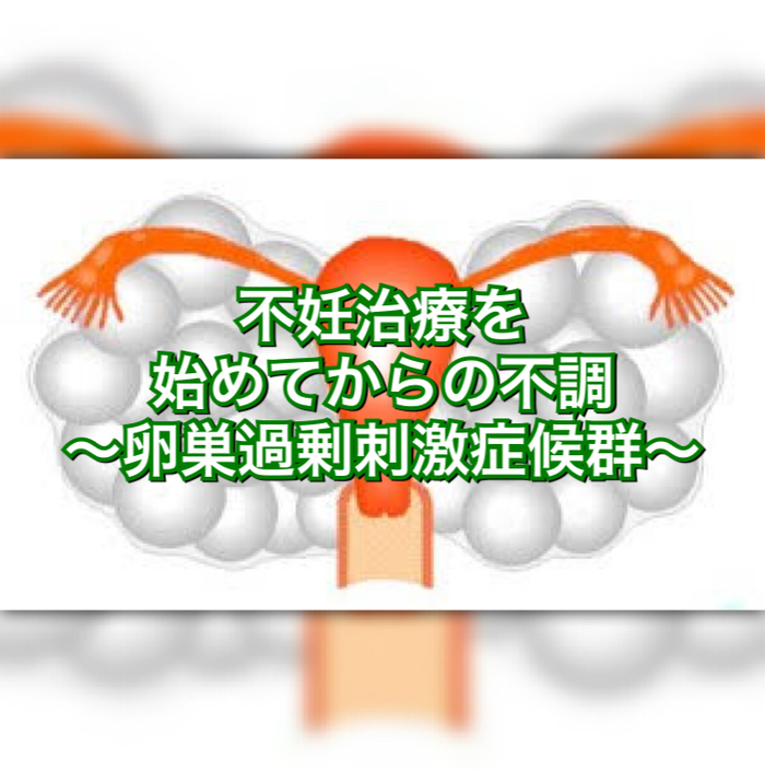 不妊治療を始めてからの不調〜卵巣過剰刺激症候群〜