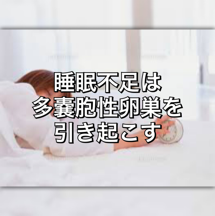 睡眠不足は多嚢胞性卵巣を引き起こす