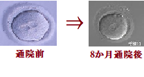 受精直後　比較208.png